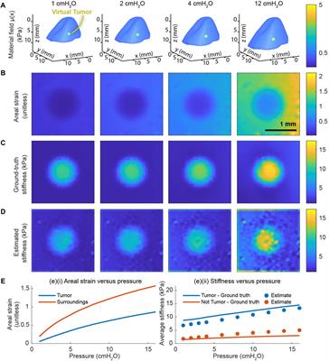 Mapping the strain-stiffening behavior of the lung and lung cancer at microscale resolution using the crystal ribcage